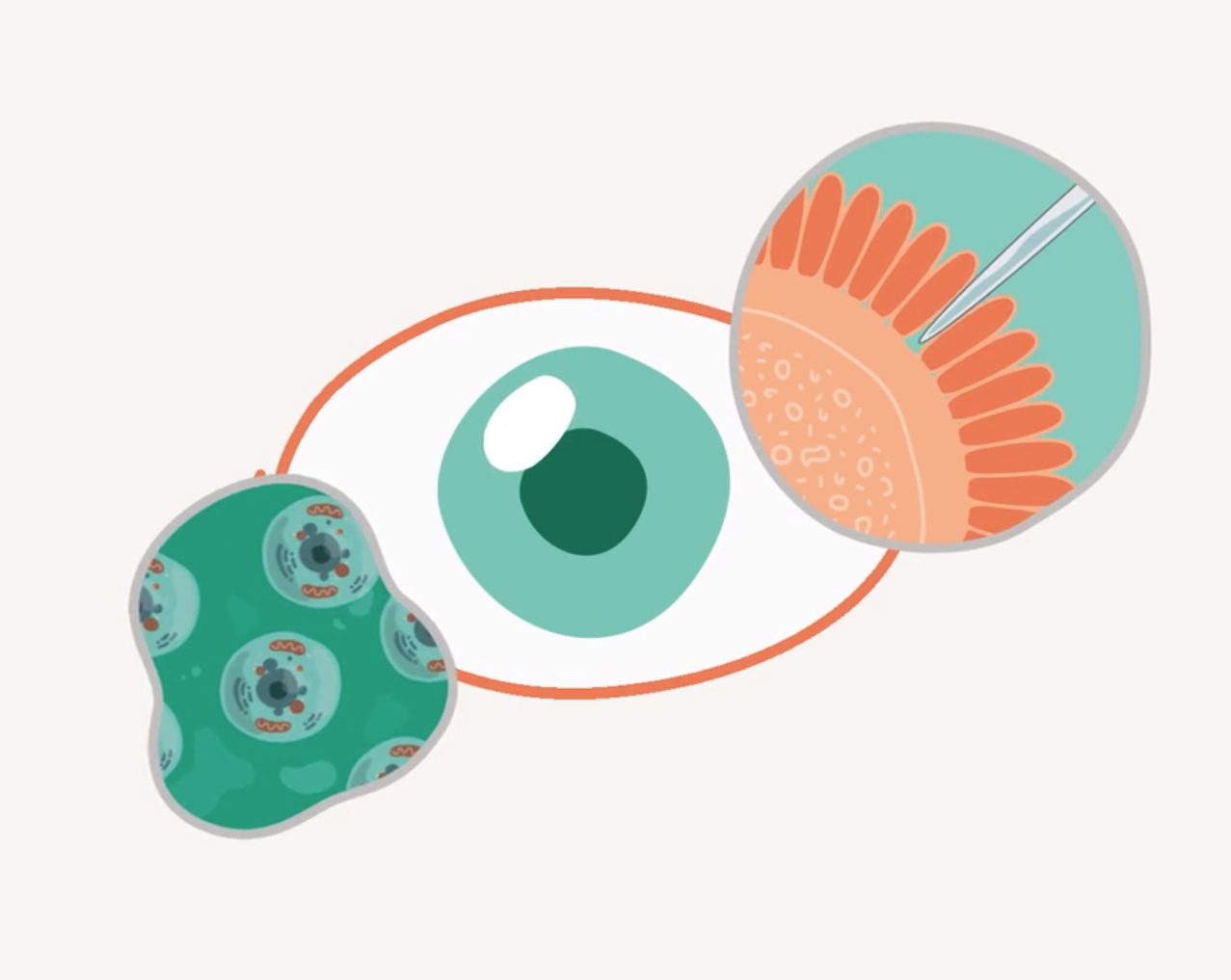 ASGCT Educational Video Retinal Disorder
